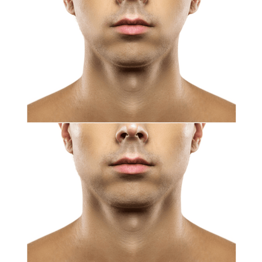 Top five facial exercises for a sharp jawline 